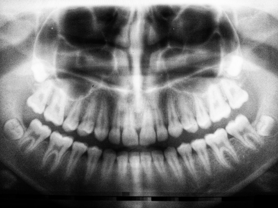photo 1522849696084 818b29dfe210cropentropycstinysrgbfitmaxfmjpgixidMnwxNDA1NTd8MHwxfHNlYXJjaHw1M3x8ZGVudGlzdCUyMGRlbnRhbHxlbnwxfDB8fHwxNjM5NDE2MjU1ixlibrb 1.2.1q80w1080